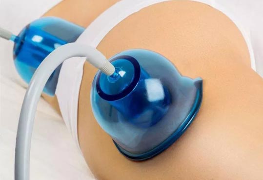 What is a Brazilian butt lift